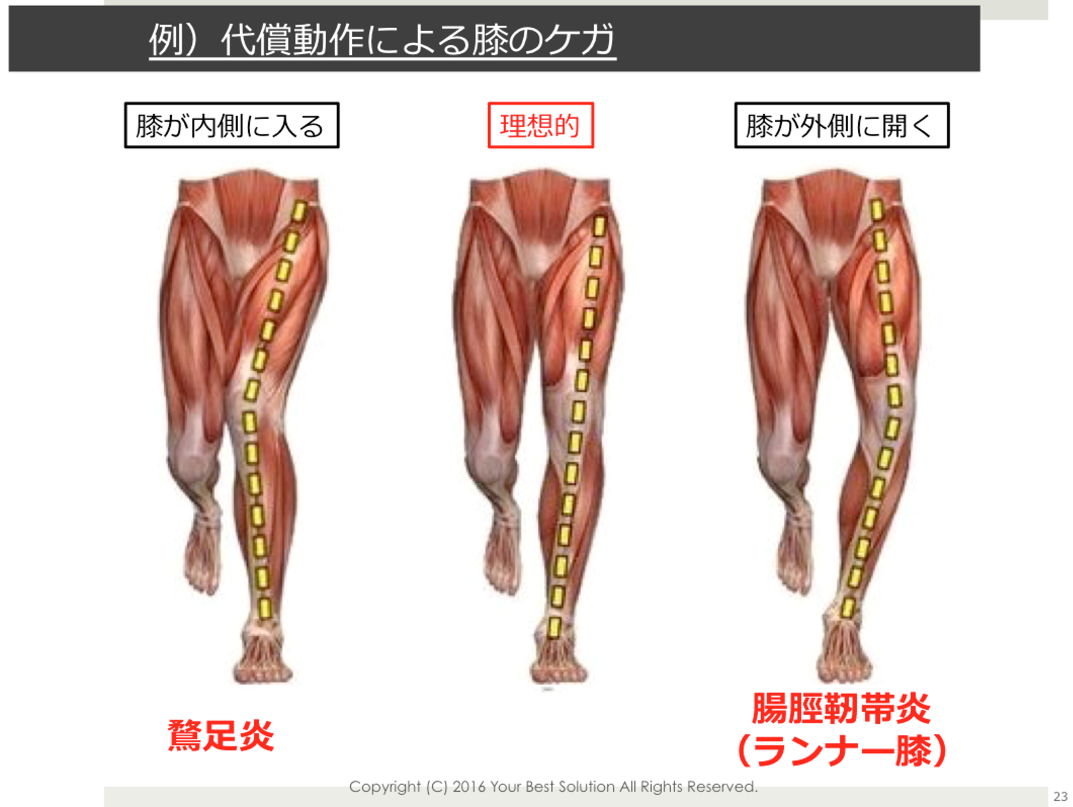 ランニング 膝 内側 痛み