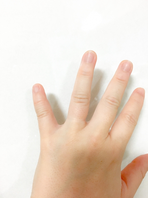 指の怪我