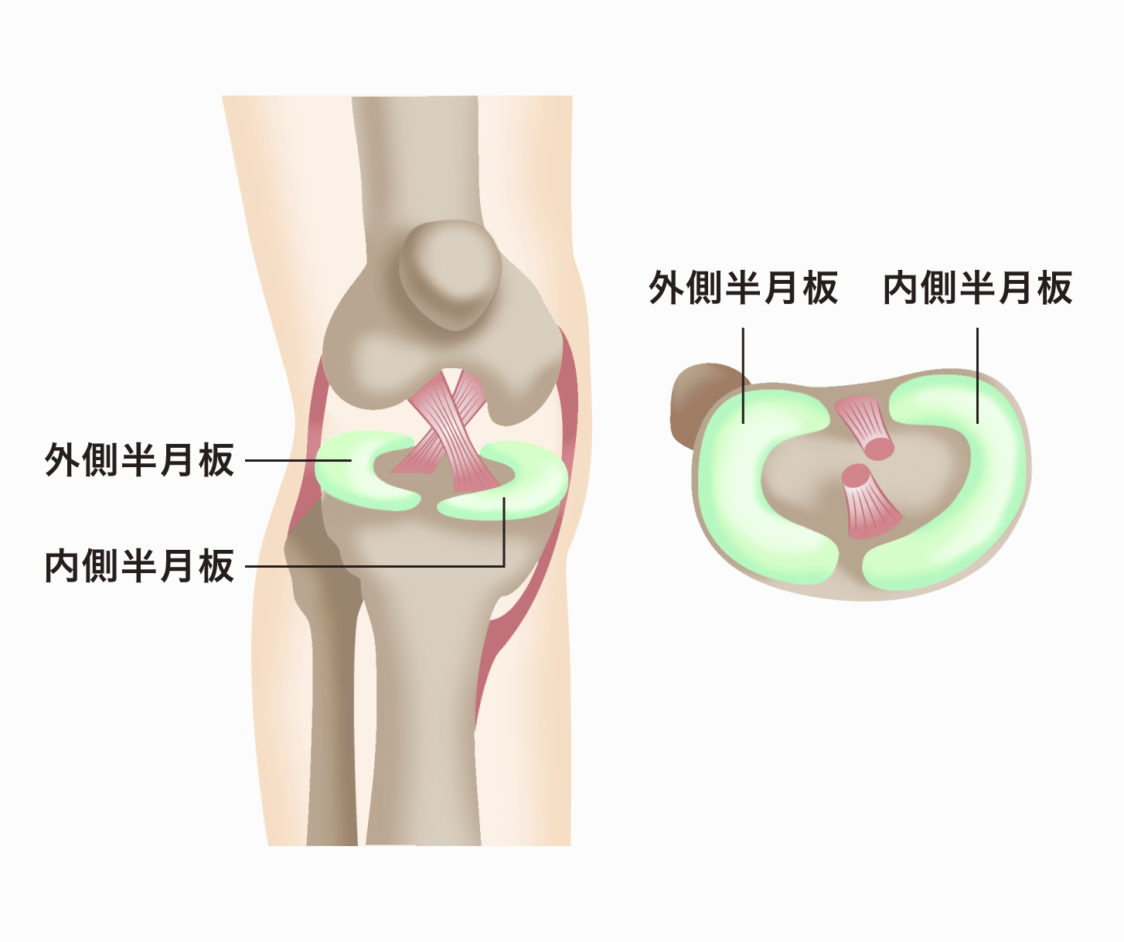 半月 板 損傷
